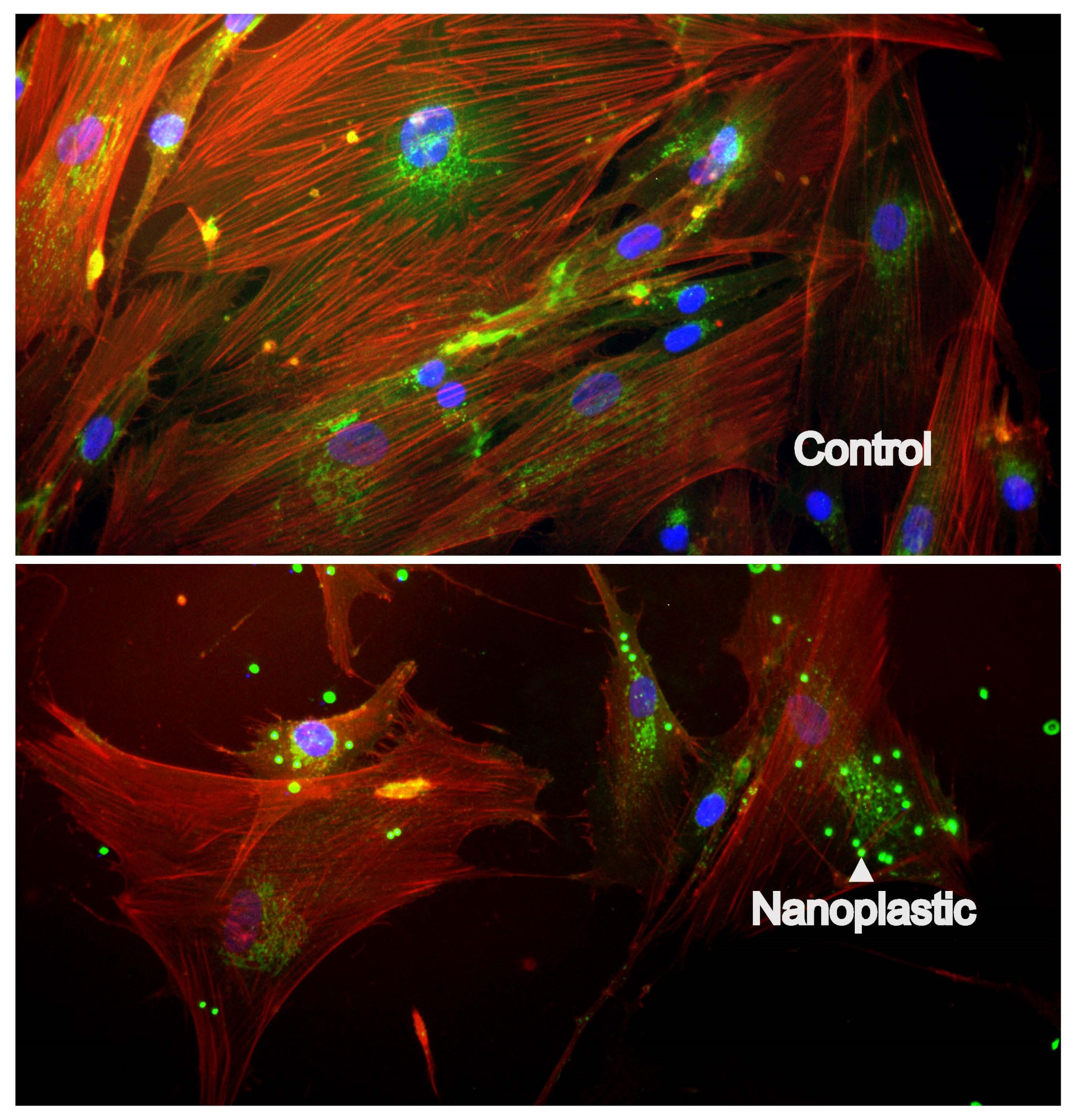Nanoplastics in human skin cells