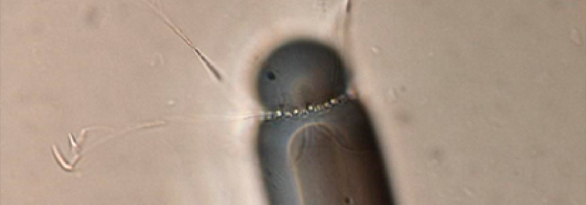 Generic representation of Microalgae composition determine the efficiency of the biological pump in Antarctica and the global ocean carbon sequestration