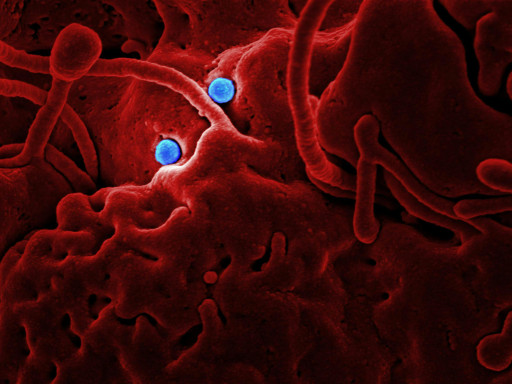 Detailed microscopic image showing red structures and blue virus particles.