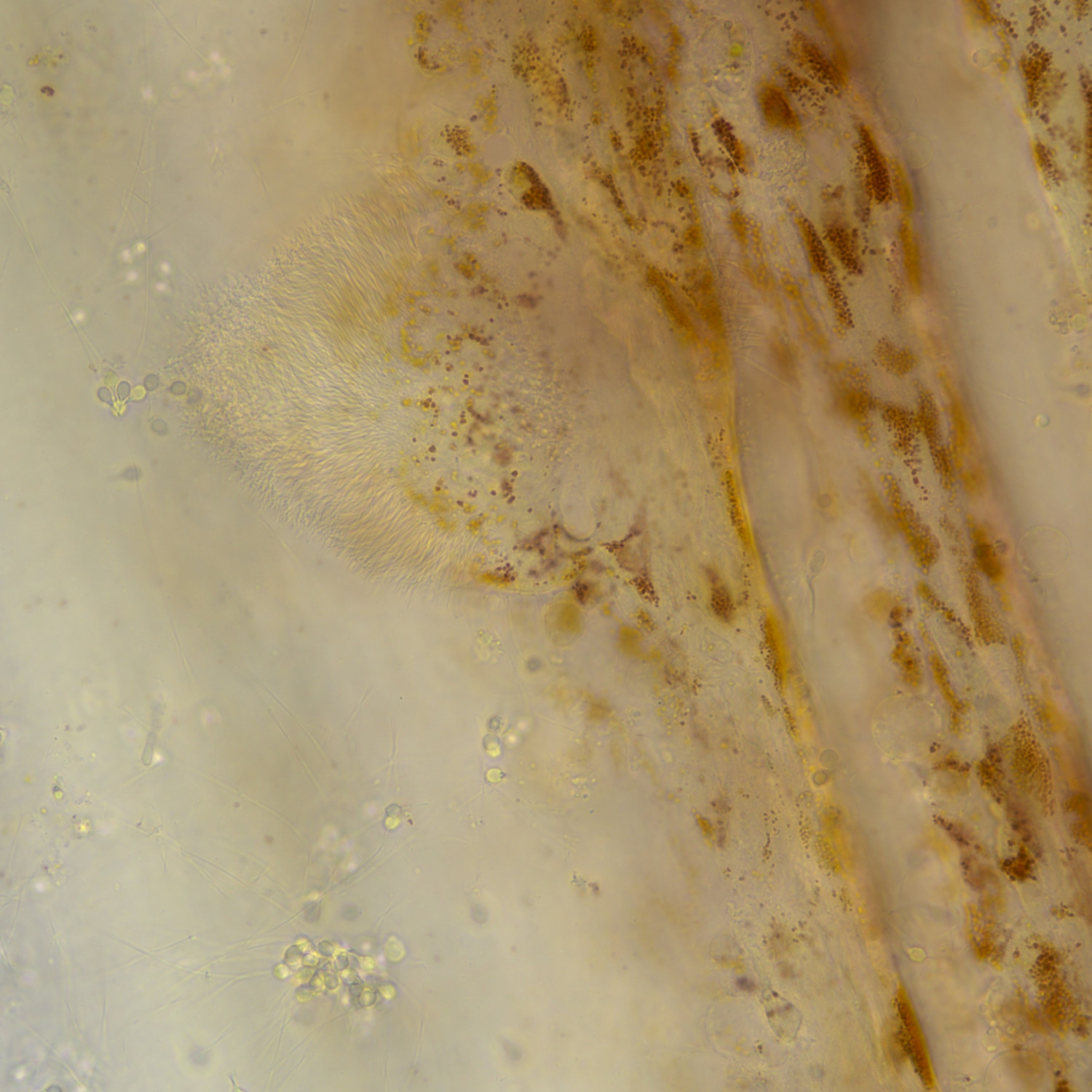 Sperm and cilia ferom gills