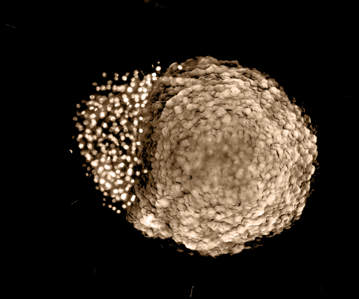 Embryo 4hpf Deconvolution