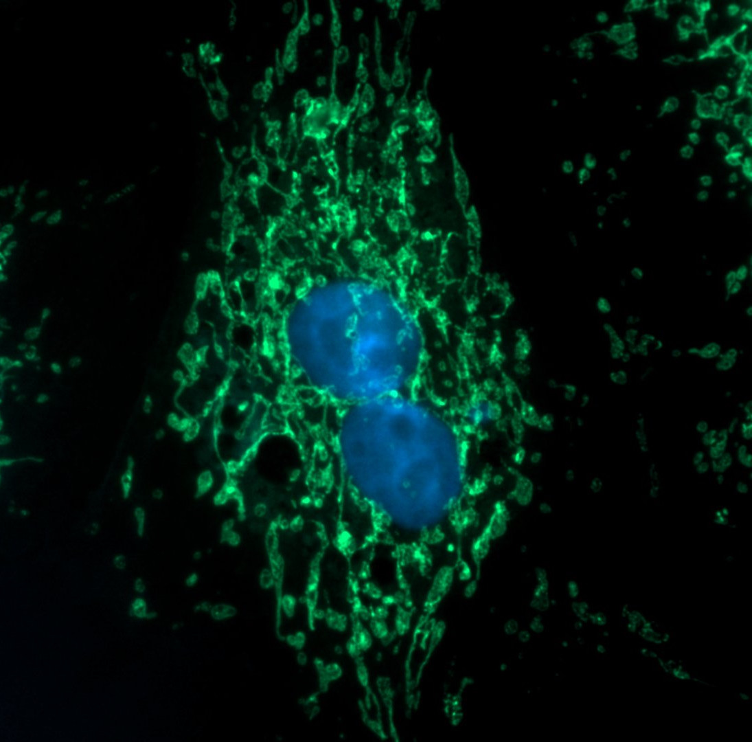 Axioscope BPAE cells-Mitotracker and nuclei-Axioscope