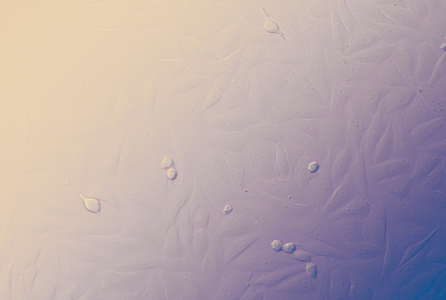 Var3 cells vertebra meager