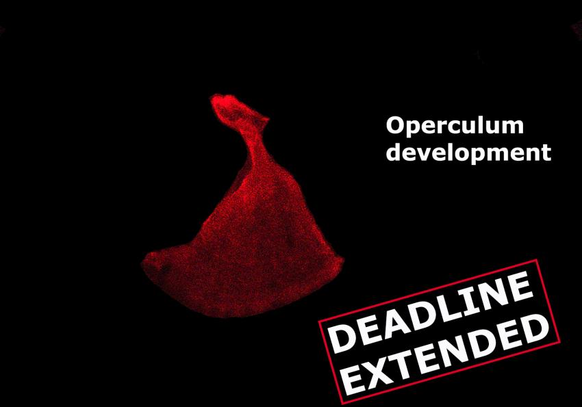 Generic representation of Zebrafish Tools for the Screening of Osteogenic Compounds