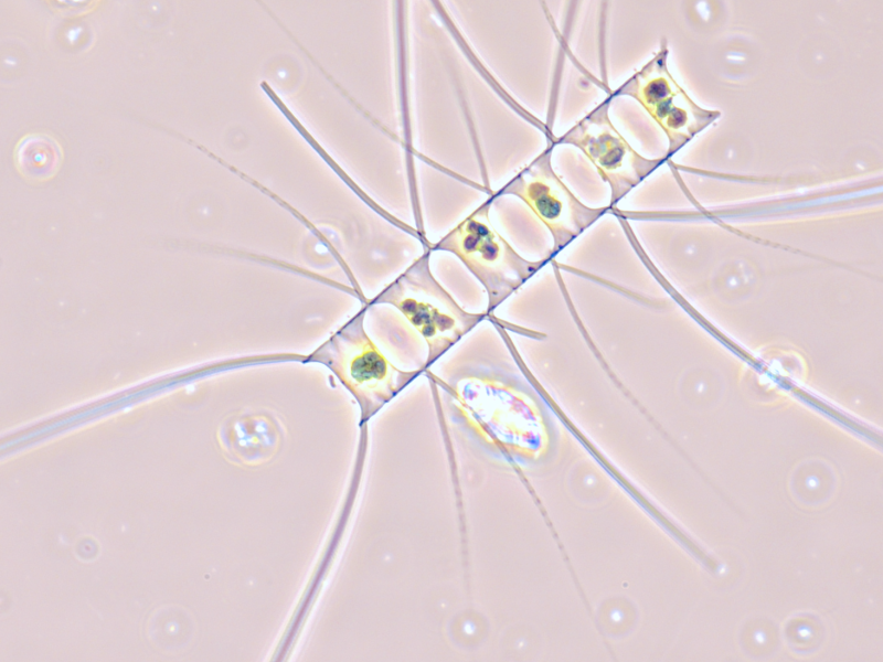 Diatom (Chaetoceros sp.) in sea water collected from the beach of Faro Island. Sample courtesy: Gabriel Bombo, GreenCoLab