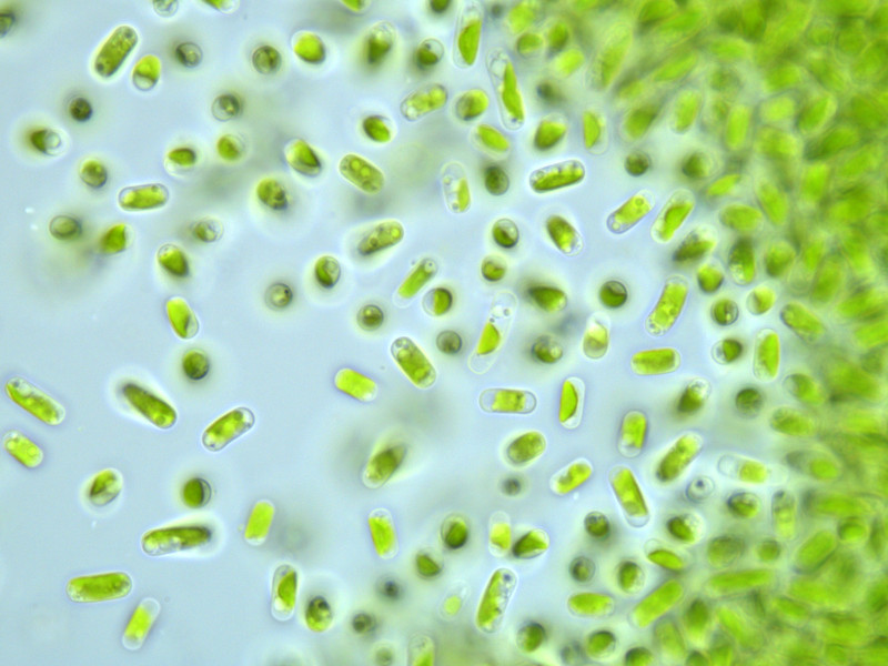 Detail of Stichococcus microalgae. MarBiotech Group.