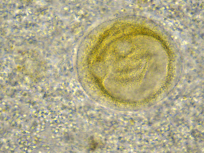 Mussel reproductive cells (oocyte and spermatozoa). Sample courtesy: Zhi Li (CEIB Group) and Ilaria Savino (University of Bari, Italy).