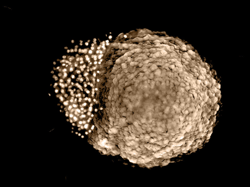 Zebrafish embryo 4 hours post fertilization, showing early stages of development and cell differentiation in two poles. Sample Courtesy: Chen Jie, CEIB Group.