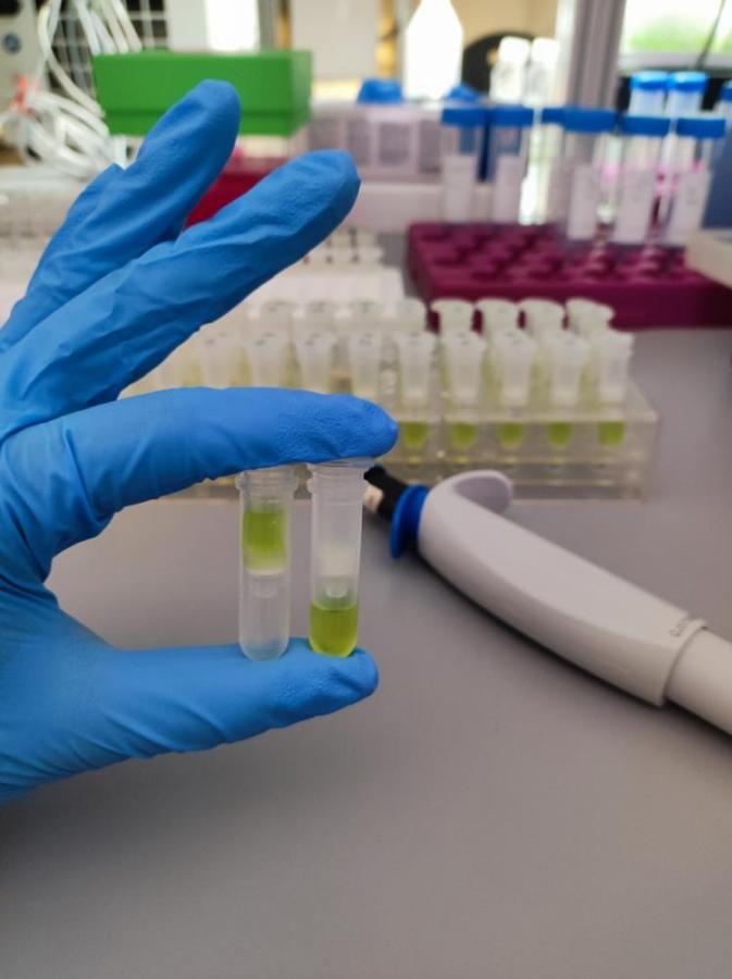 DNA Extraction Microbiome Microalgae