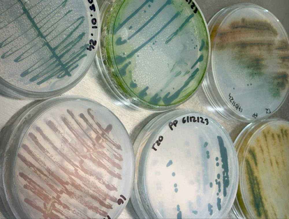 Estirpes de microalgas isoladas do efluente da industria textil