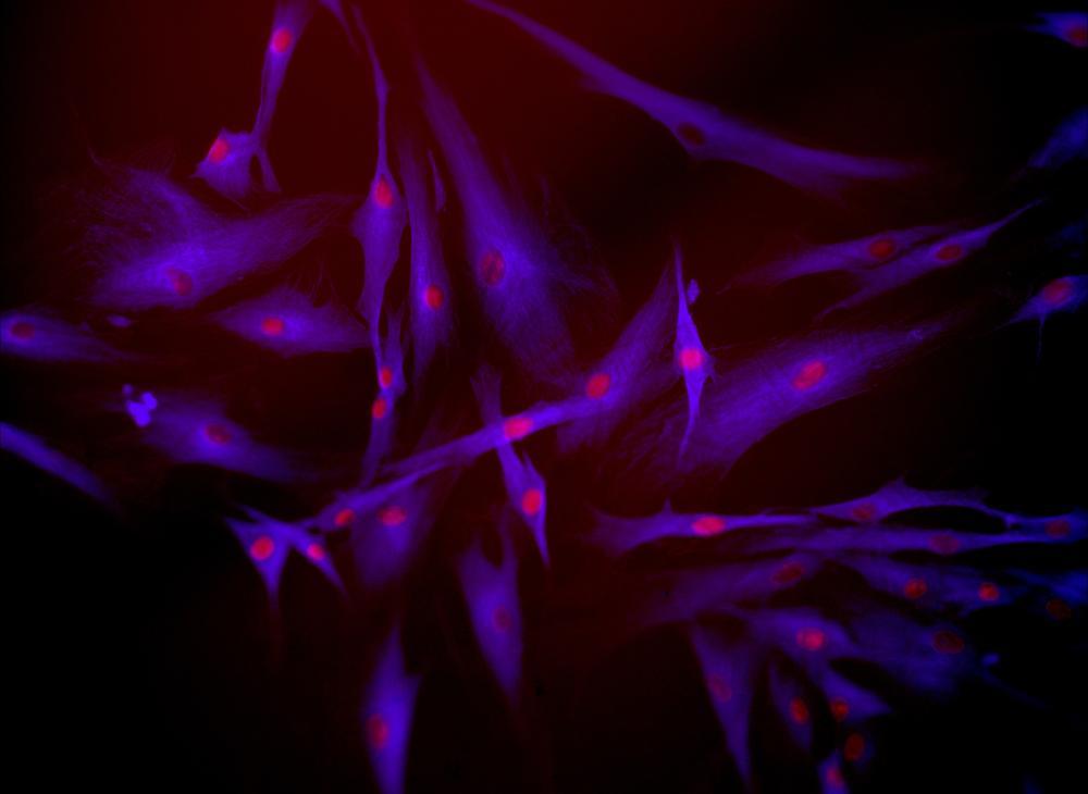 Human dermal fibroblasts (alpha tubullin in purple and nuclei in pink)