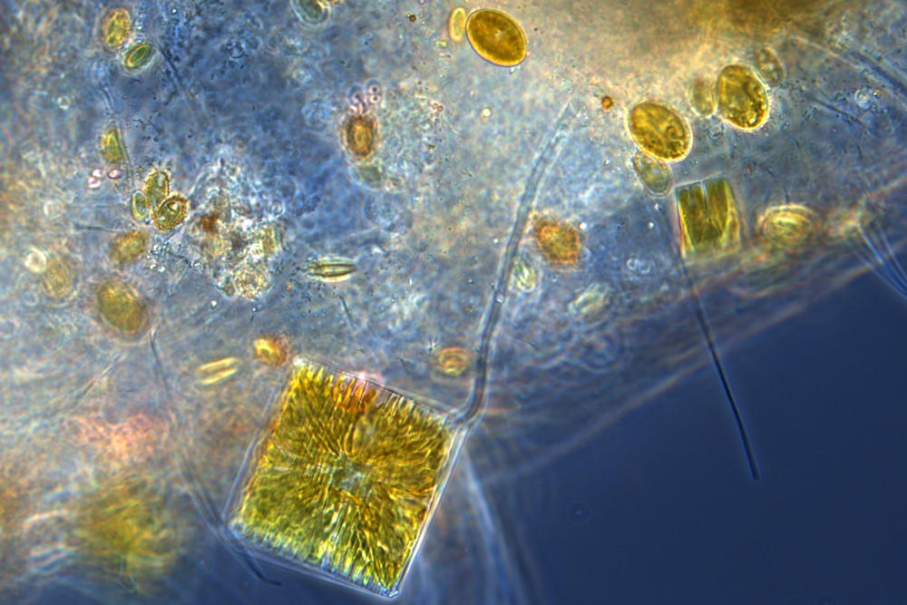 Water sample from Ria Formosa - Phase Contrast Microscopy